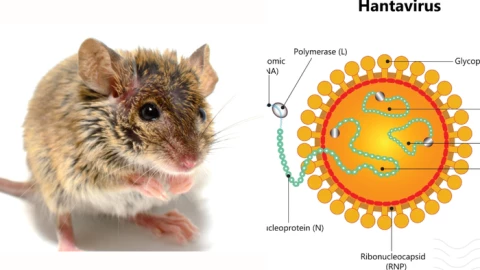Sắp có loại virus “Covid tiếp theo” 8 ca nhiễm có tới 3 ca tử vong